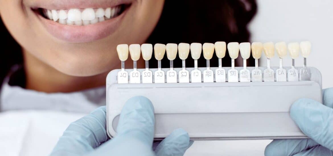 Women having smile makeover with veneers