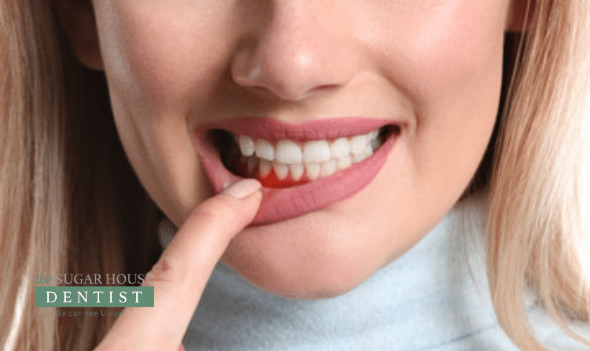 Things You Should Know About Gum Disease Treatment
