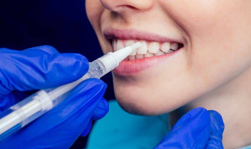 The Relationship Between Dental Crowns And Root Canals