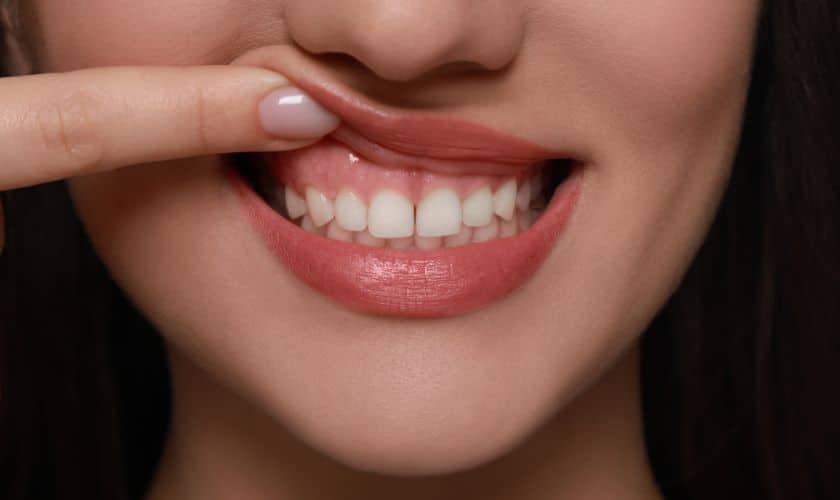 Gum rejuvenation treatment explained