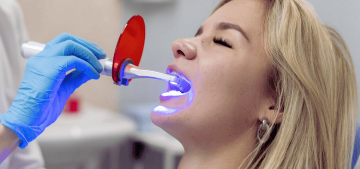 Can Teeth Whitening Fix All Types of Teeth Discoloration