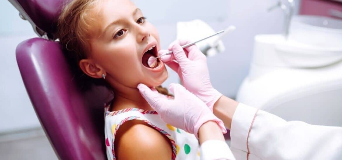 do cavities in baby teeth need to be filled