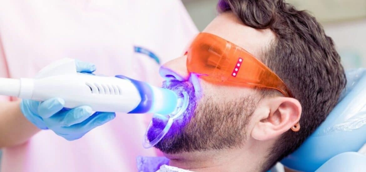 Remove yellow stains from teeth with professional teeth whitening