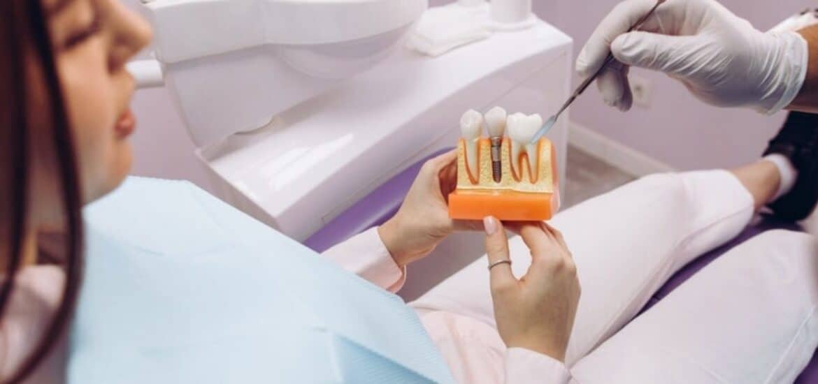 single missing tooth restoration by dental implants in salt lake city