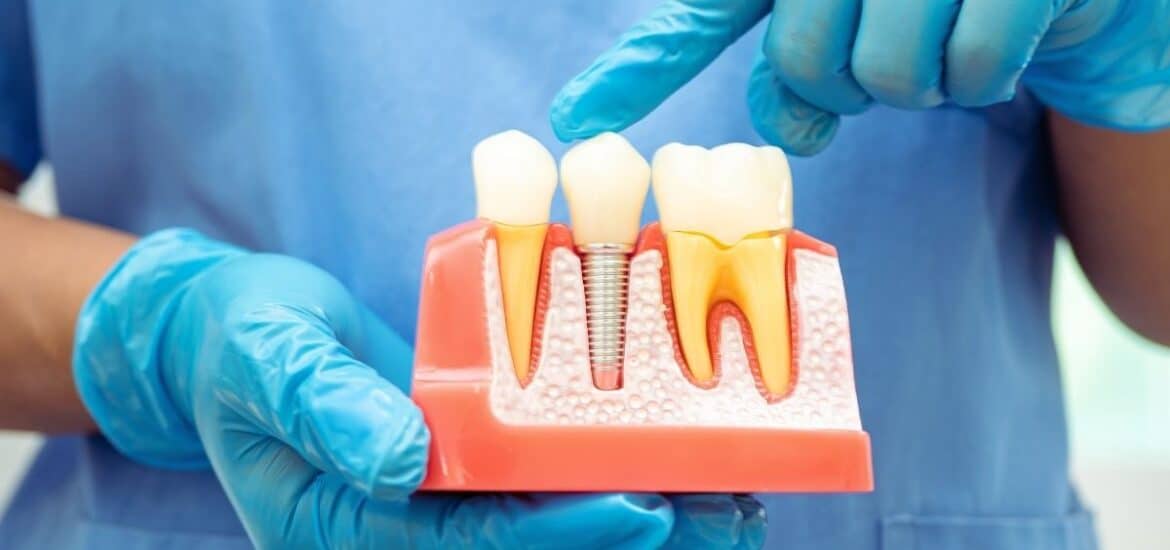 Infected Dental Implant: Can It Be Saved?