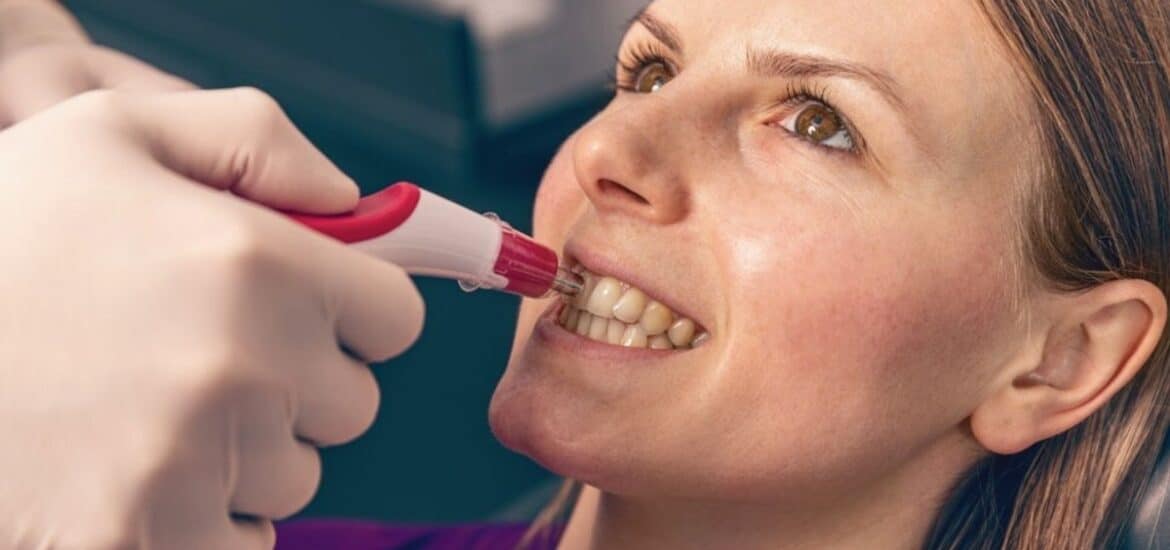 Signs You Need Professional Teeth Whitening in Salt Lake City