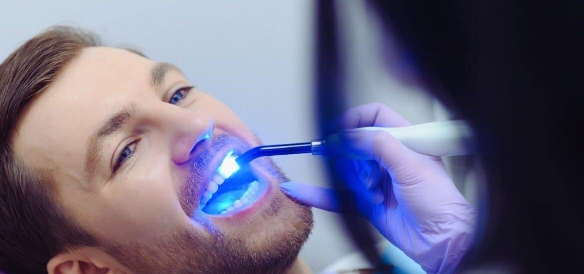 A man is smiling widely while lying back in a dental chair for a teeth-whitening procedure