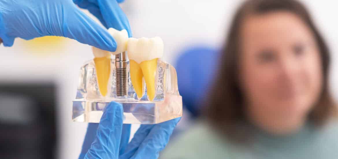 Dentist holding a dental implant model illustrating tooth replacement for patients considering dental implants to restore missing teeth and improve oral health.