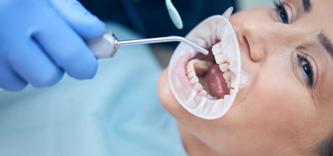 Dentist examining a patient for wisdom tooth warning signs during a routine dental checkup
