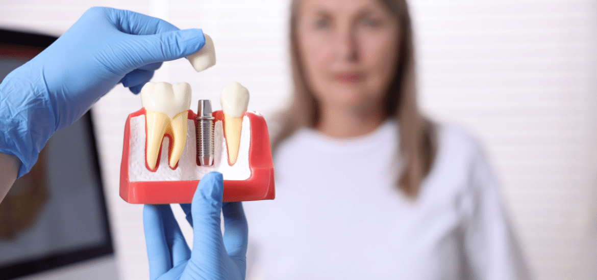 Women looking at the dental implants structure in the dental office of The Sugar House Dentist.